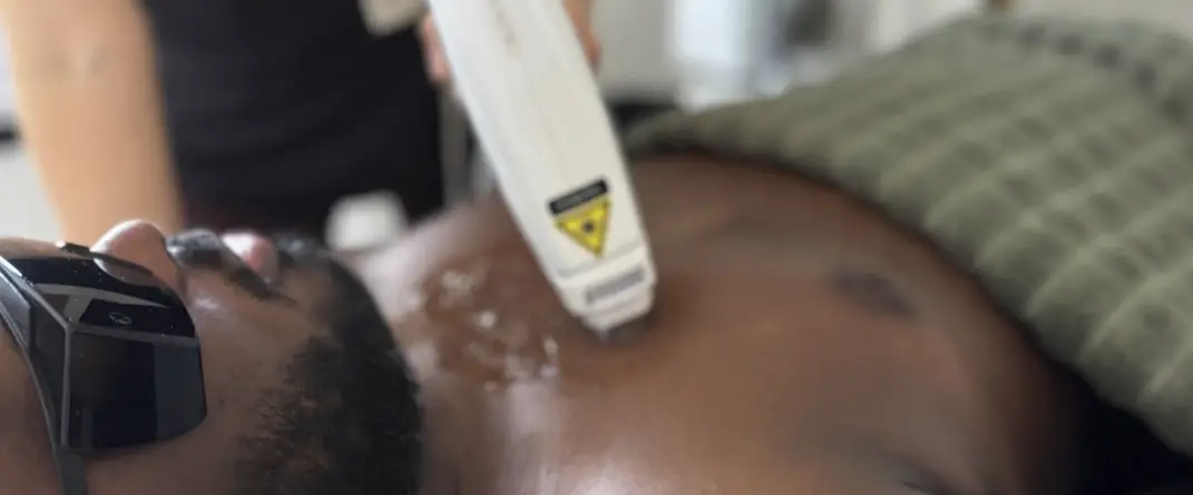 Épilation Laser Corps